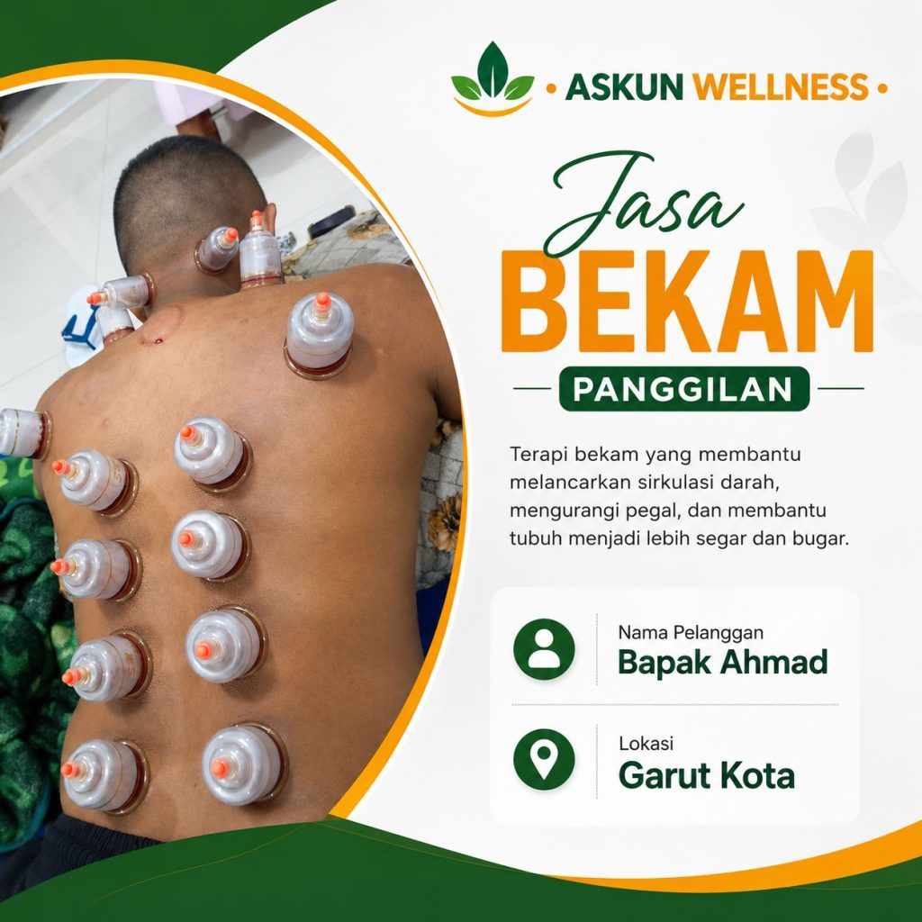 Pijat Cikelet Garut – Jasa Bekam, Akupuntur & Layanan Pijat Panggilan