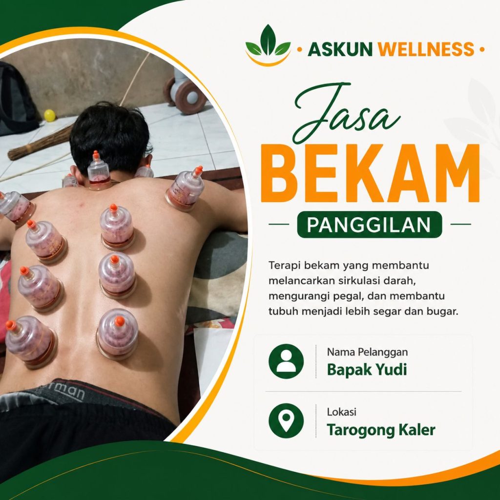 Akupuntur Pamulihan Garut – Pijat & Bekam untuk Relaksasi